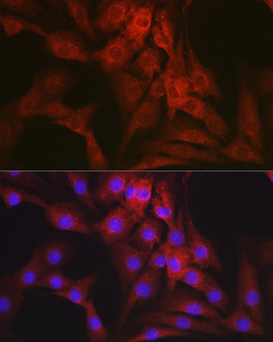 Mineralocorticoid receptor (NR3C2) Rabbit pAb