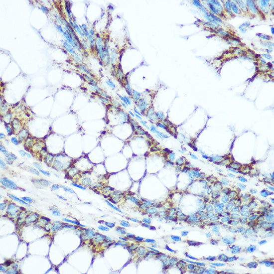 UQCRC1 Rabbit pAb