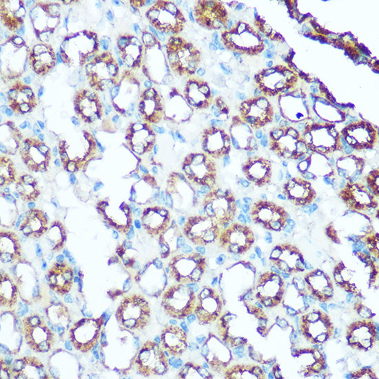 UQCRC1 Rabbit pAb