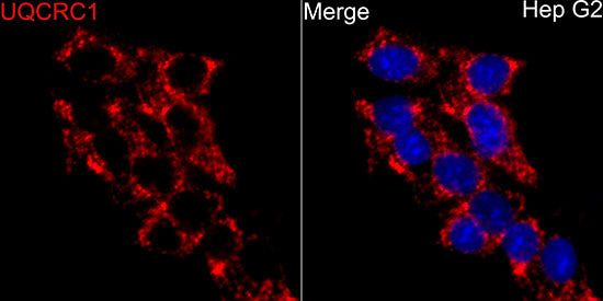 UQCRC1 Rabbit pAb