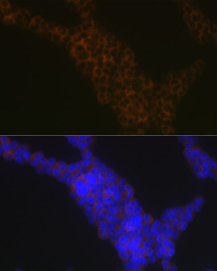 LSP1 Rabbit mAb