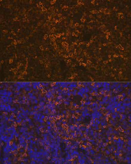 LSP1 Rabbit mAb