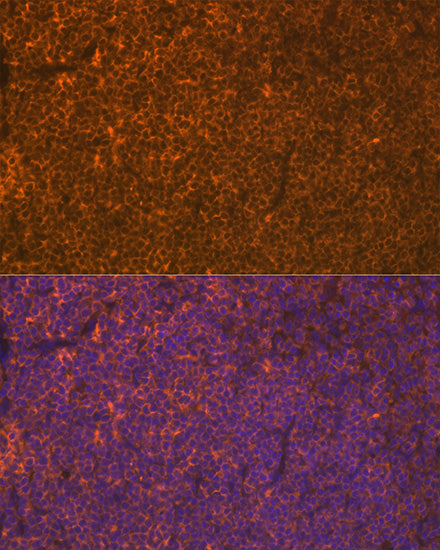 LSP1 Rabbit mAb