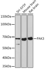 PAK3 Rabbit mAb