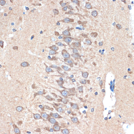 PAK3 Rabbit mAb
