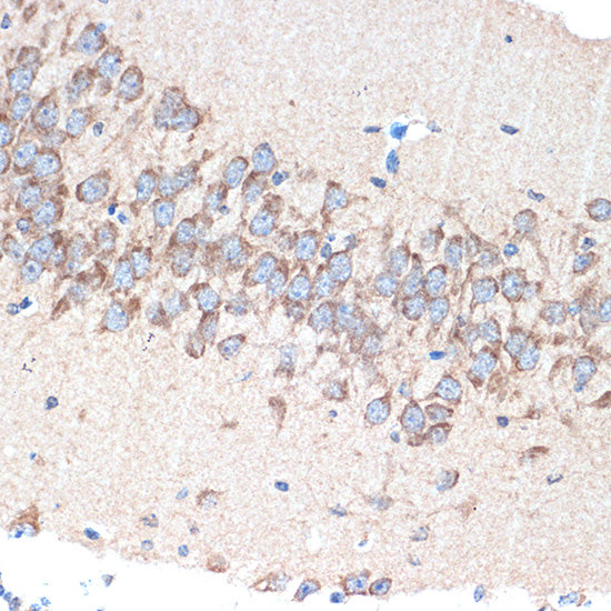 PAK3 Rabbit mAb