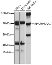 RPA70/RPA1 Rabbit mAb