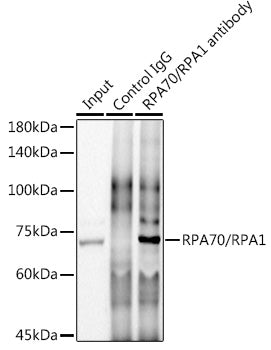 RPA70/RPA1 Rabbit mAb