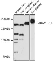ADAMTS13 Rabbit mAb
