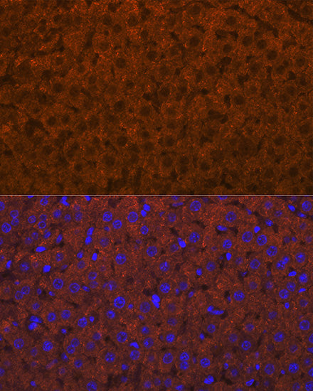 ADAMTS13 Rabbit mAb