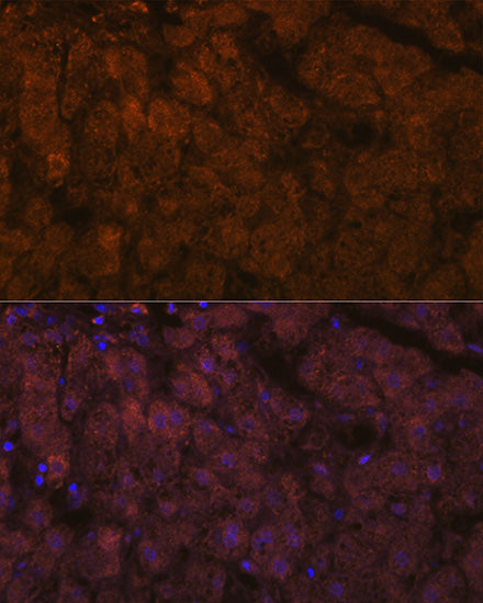 ADAMTS13 Rabbit mAb