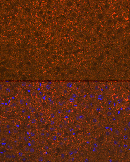 ADAMTS13 Rabbit mAb