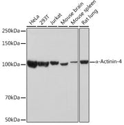 α-Actinin-4 Rabbit mAb