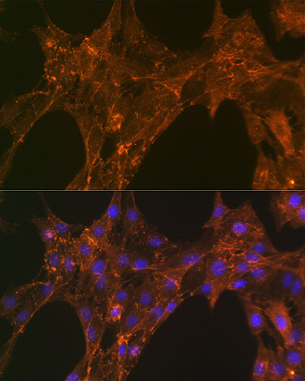 α-Actinin-4 Rabbit mAb