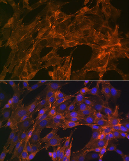 α-Actinin-4 Rabbit mAb