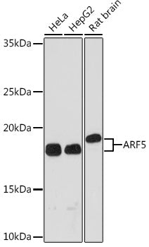 ARF5 Rabbit mAb