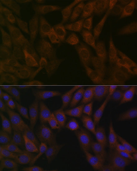 ARF5 Rabbit mAb