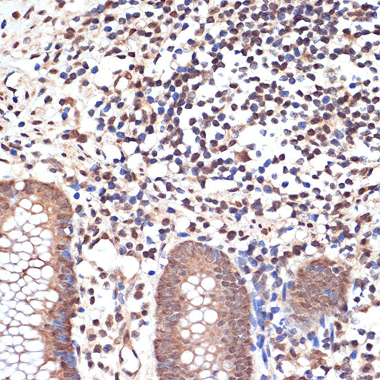 KAT8/MYST1/MOF Rabbit mAb