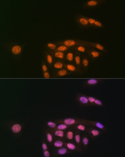 KAT8/MYST1/MOF Rabbit mAb