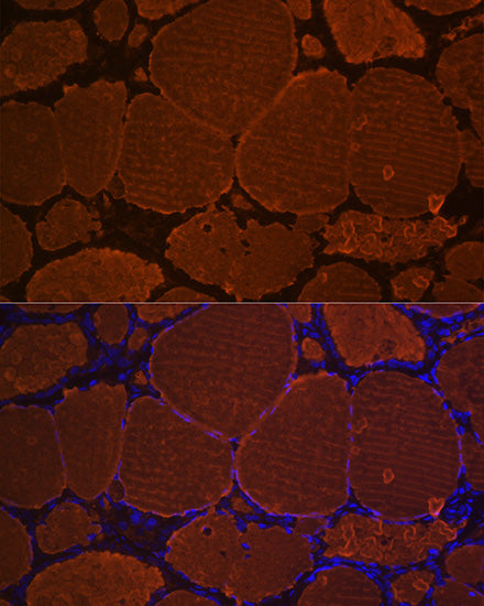 Thyroglobulin Rabbit mAb