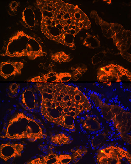 Thyroglobulin Rabbit mAb