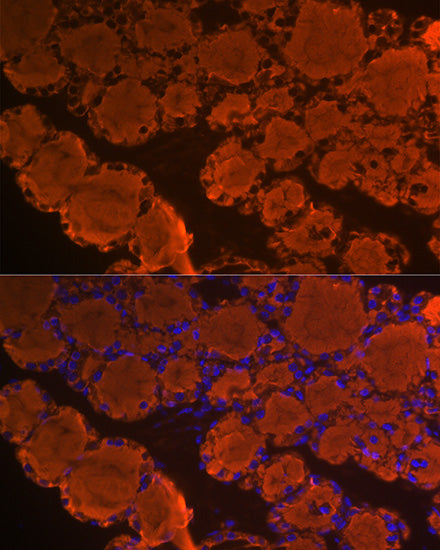 Thyroglobulin Rabbit mAb