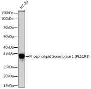 Phospholipid Scramblase 1 (PLSCR1) Rabbit mAb