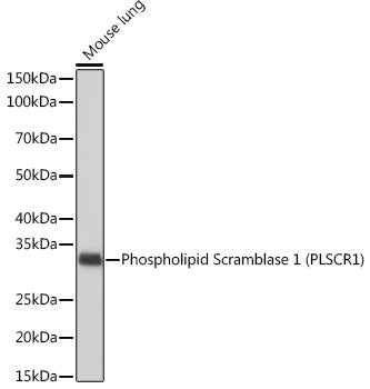 Phospholipid Scramblase 1 (PLSCR1) Rabbit mAb