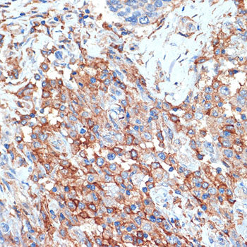 Phospholipid Scramblase 1 (PLSCR1) Rabbit mAb