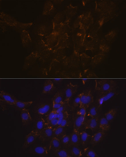 Phospholipid Scramblase 1 (PLSCR1) Rabbit mAb