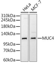 MUC4 Rabbit mAb
