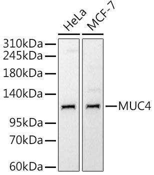 MUC4 Rabbit mAb