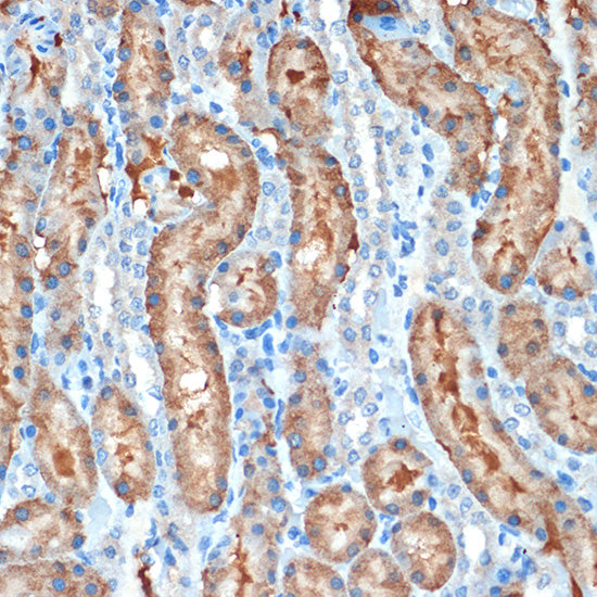 MUC4 Rabbit mAb