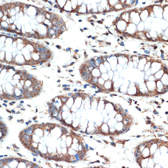 MUC4 Rabbit mAb