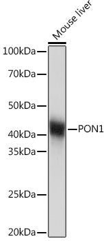 PON1 Rabbit mAb