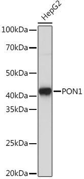 PON1 Rabbit mAb