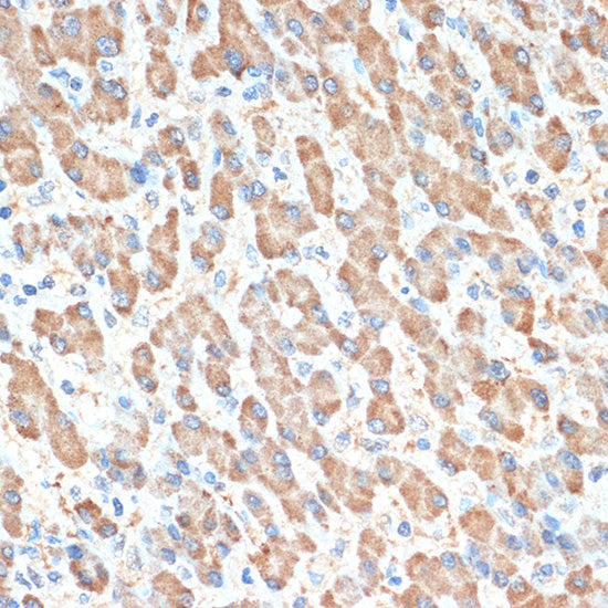 PON1 Rabbit mAb