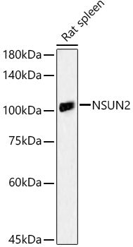 NSUN2 Rabbit pAb