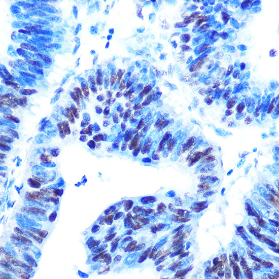 USP7/HAUSP Rabbit mAb