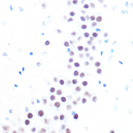 USP7/HAUSP Rabbit mAb
