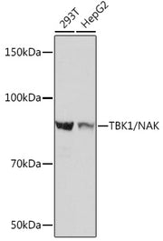 [KO Validated] TBK1/NAK Rabbit mAb