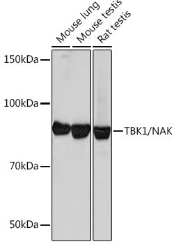 [KO Validated] TBK1/NAK Rabbit mAb