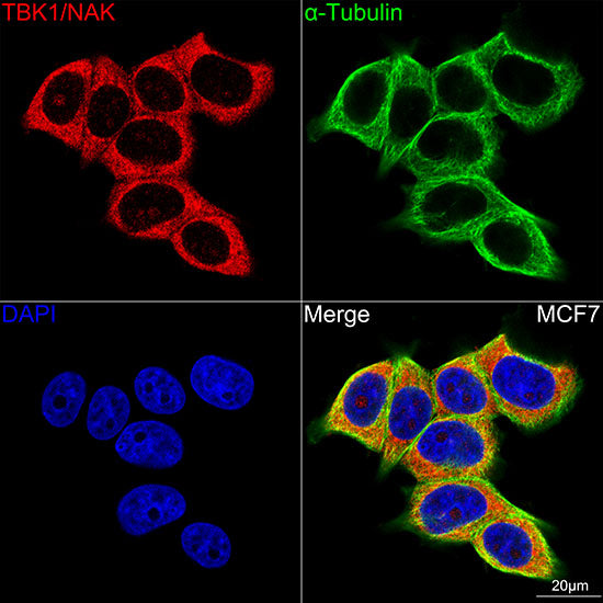 [KO Validated] TBK1/NAK Rabbit mAb