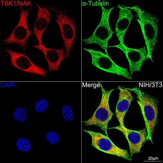[KO Validated] TBK1/NAK Rabbit mAb