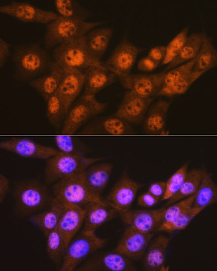 PSMA1 Rabbit mAb