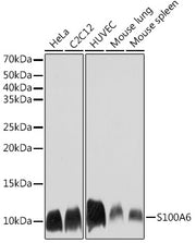 S100A6 Rabbit mAb