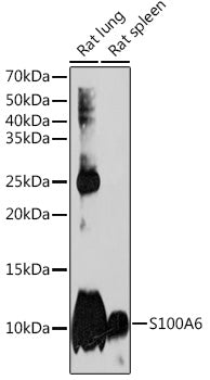 S100A6 Rabbit mAb