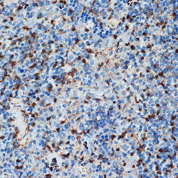 S100A6 Rabbit mAb