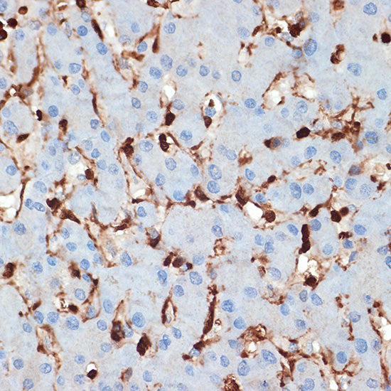 S100A6 Rabbit mAb
