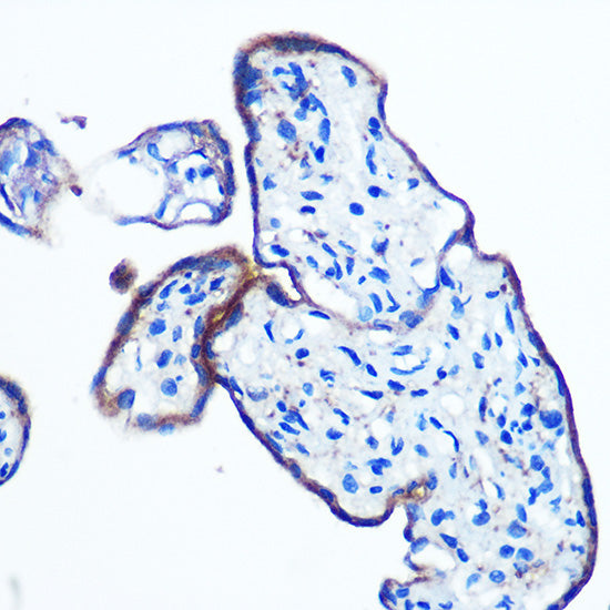 IKKε Rabbit mAb